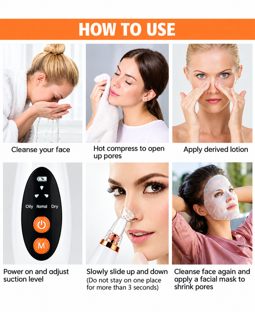 Blackhead Remover Vacuum – 3 Suction Levels, 6 Heads, Rechargeable